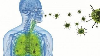 Náhledový obrázek - Epidemie chřipky odeznívá, ale přetrvává v některých regionech