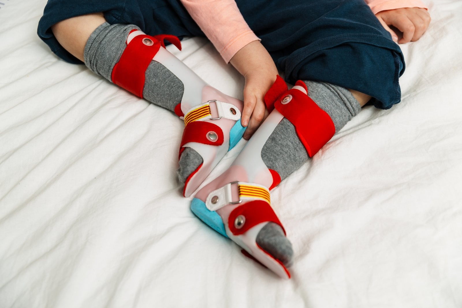 Léčba a projevy golfové nohy