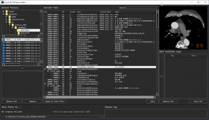 Quick DICOM Tag Editor - náhled