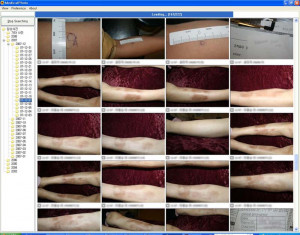 MedicalPhoto - náhled