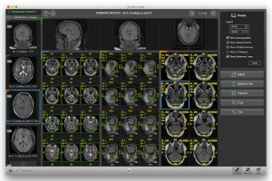 Escape Medical Viewer - náhled